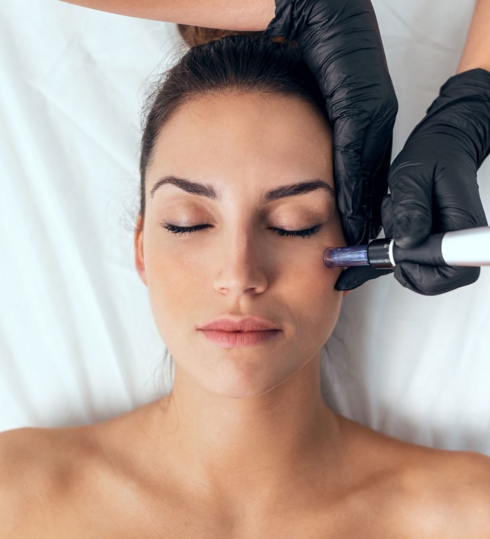 microneedling-2