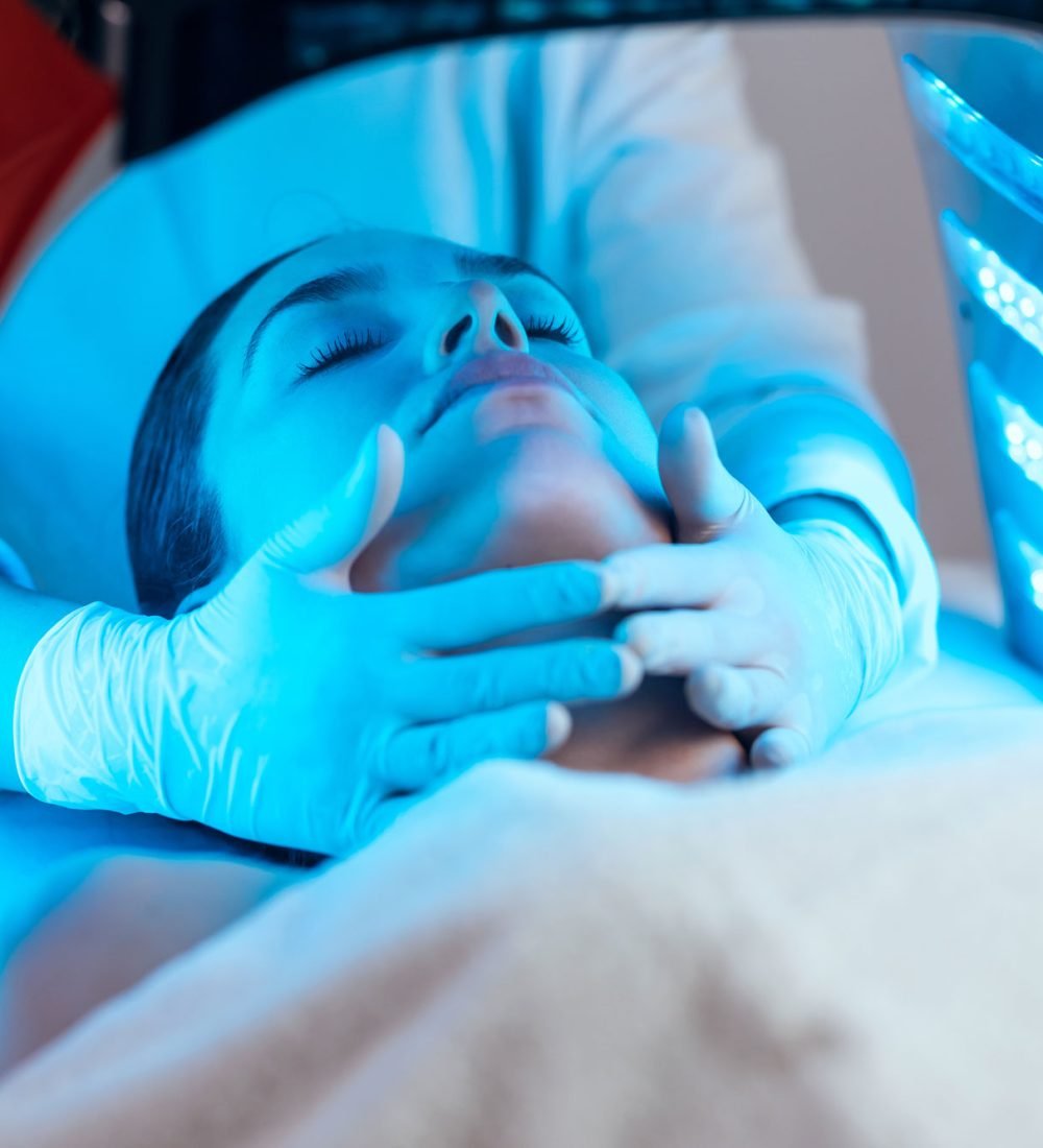 microneedling-4